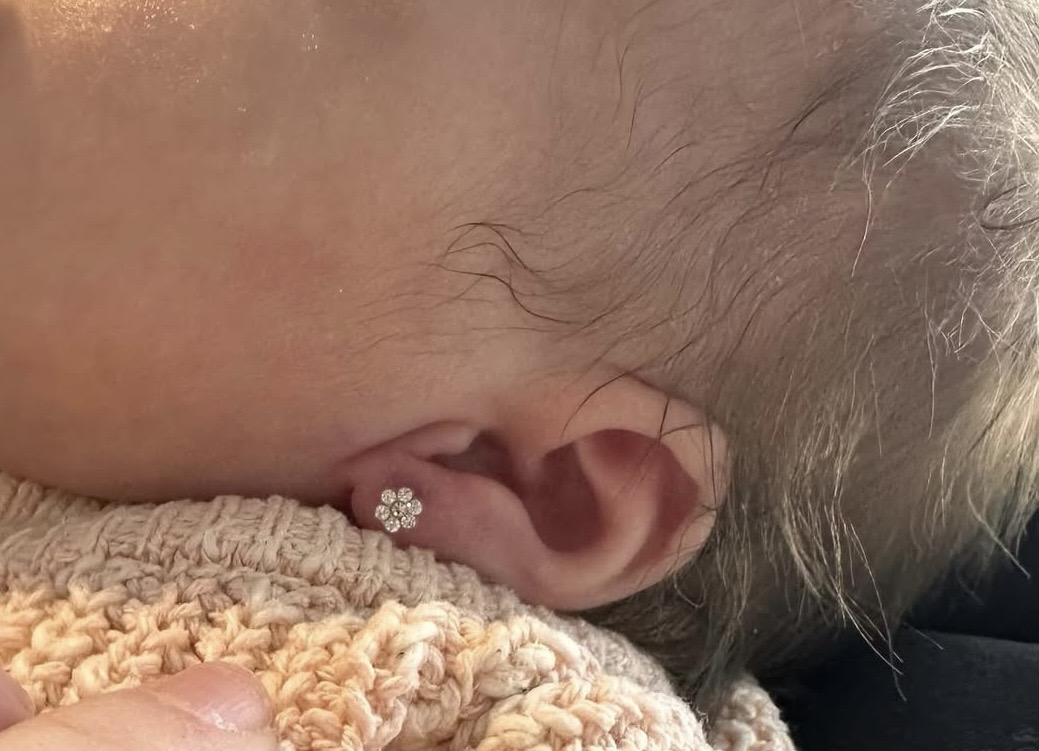 Close-up of a freshly pierced ear with a small flower-shaped stud
